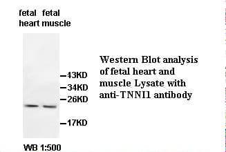 TNNI1 Antibody