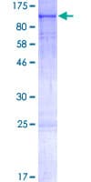 Human PRKG2 / CGKII Protein (Recombinant GST)