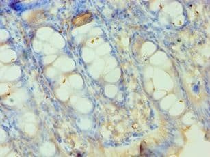 SMYD3 Antibody (aa199-428)