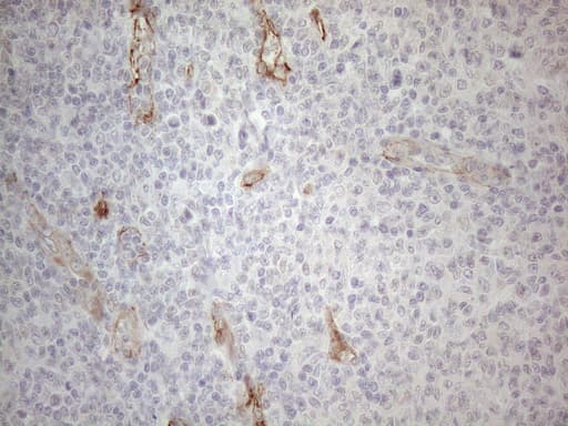 Monoclonal Mouse anti-Human SIP1 Antibody (clone OTI4C11, Carrier-free, IHC, WB)