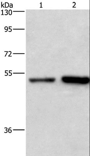 Polyclonal Rabbit anti-Human SYT4 Antibody (IHC, WB)