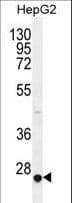 Polyclonal Rabbit anti-Human CACNG6 Antibody (aa108-136, IHC, IF, WB)