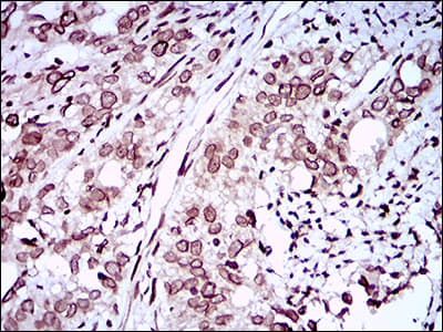 ZEB1 / AREB6 Antibody (aa967-1108, clone 2A8H3)