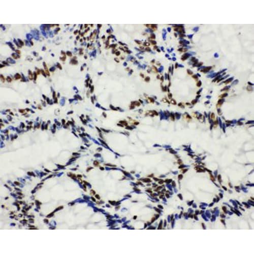 Polyclonal Rabbit anti-Human HDAC3 Antibody (aa1-18, IHC, WB)