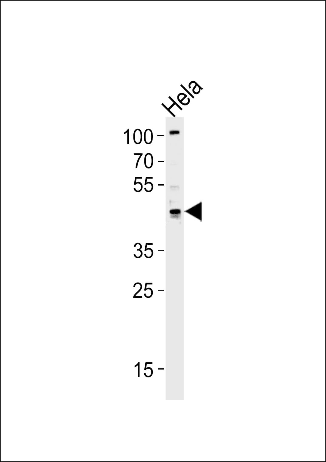 TRIP13 Antibody (aa363-392)