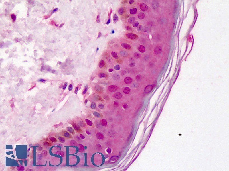 IHC-plus™ Polyclonal Rabbit anti-Human FANCD2 Antibody (aa217-226, IHC)