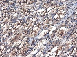 TUBAL3 Antibody (clone OTI4C5)
