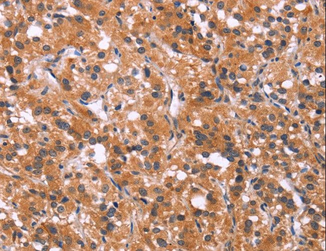 MAPK11 / SAPK2 / p38 Beta Antibody