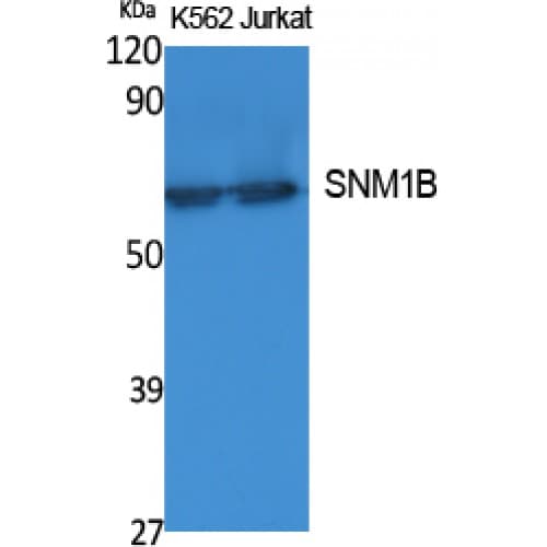 Polyclonal Rabbit anti-Human DCLRE1B Antibody (C-terminal, WB)