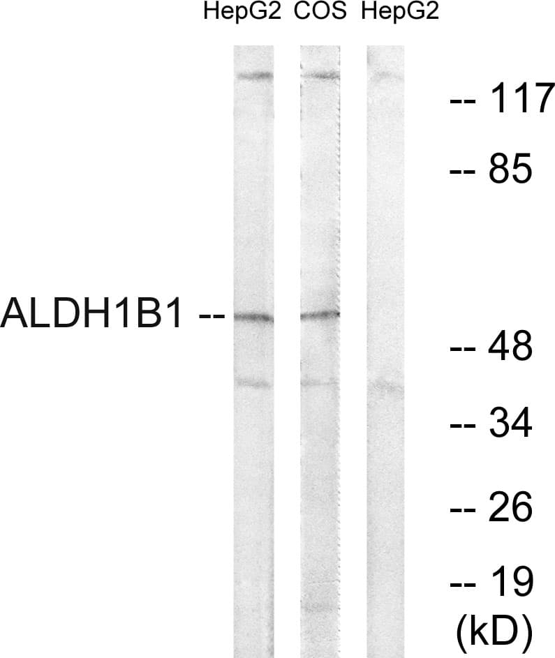 ALDH1B1 Antibody (aa311-360)