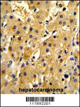 Polyclonal Rabbit anti-Human HPD Antibody (aa92-121, IHC, WB)