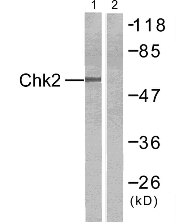 CHEK2 / CHK2 Antibody (p516)