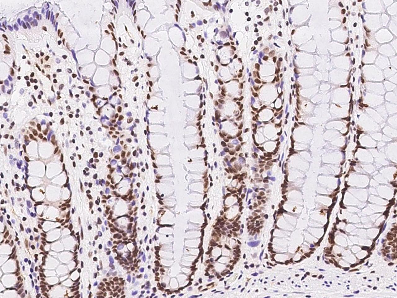 GMEB1 Antibody