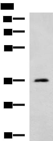 AMOG / ATP1B2 Antibody