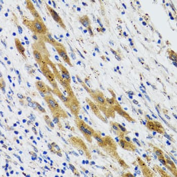 IHC-plus™ Polyclonal Rabbit anti-Human PLA2G2D Antibody (IHC, IF, WB)