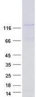 Human VWA5B1 Protein (Recombinant Myc-DDK (Flag))