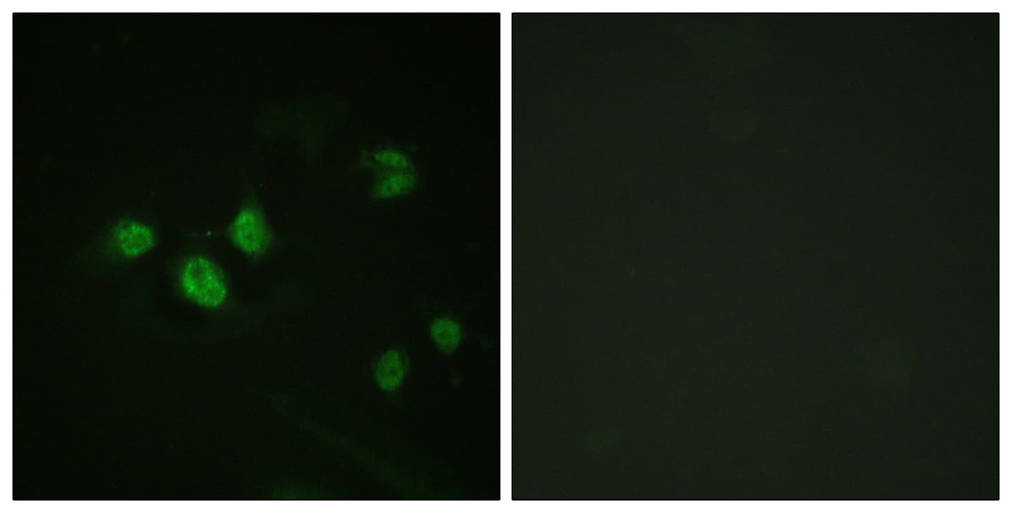 SP1 Antibody (phospho-Thr453)