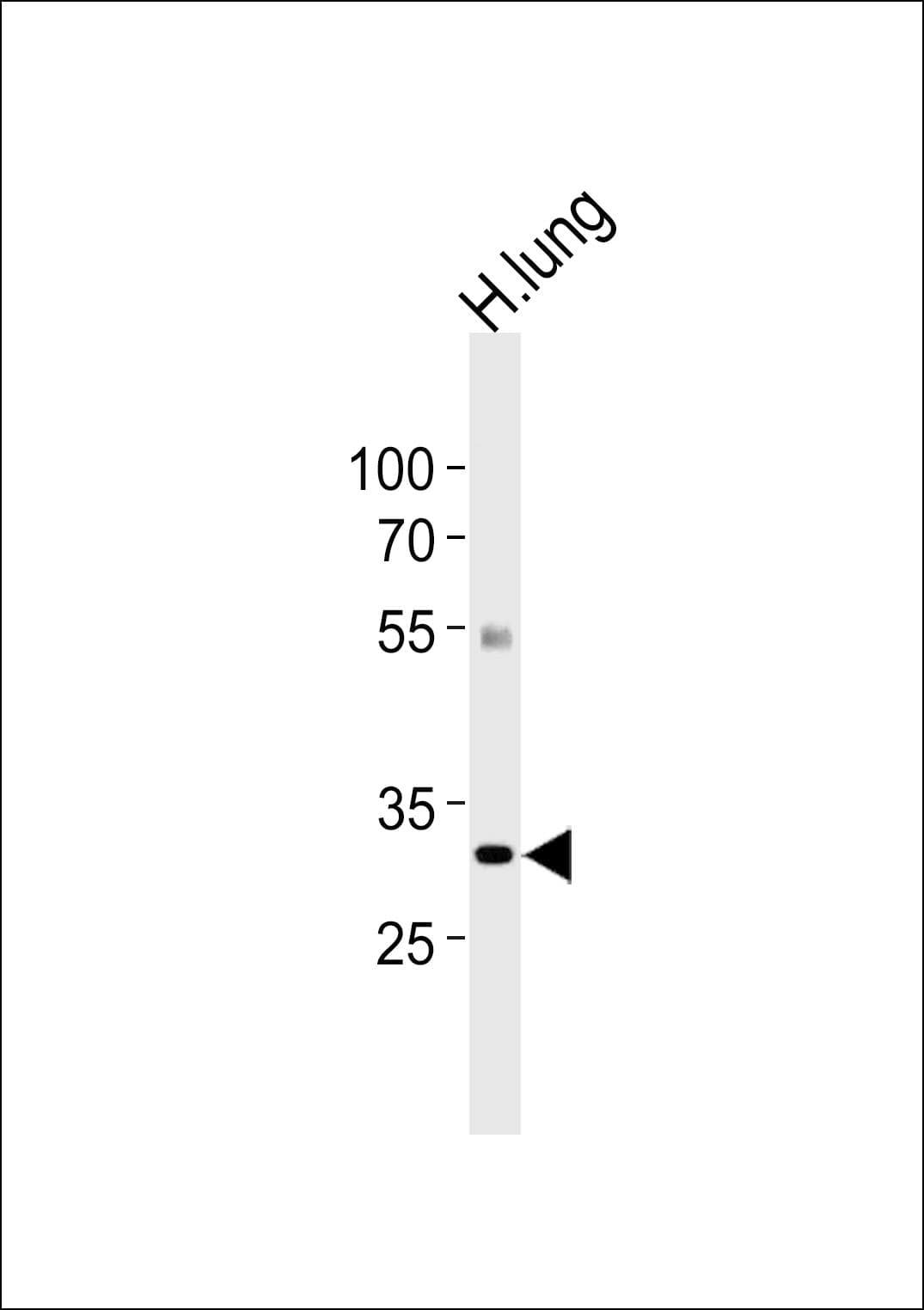 CSF2RA / CD116 Antibody (aa366-394)