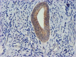 TIMP2 Antibody (clone OTI2G7)