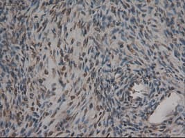 CPA1 / Carboxypeptidase A Antibody (clone OTI4F1)