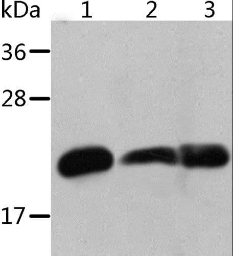 CRYAB / Alpha B Crystallin Antibody