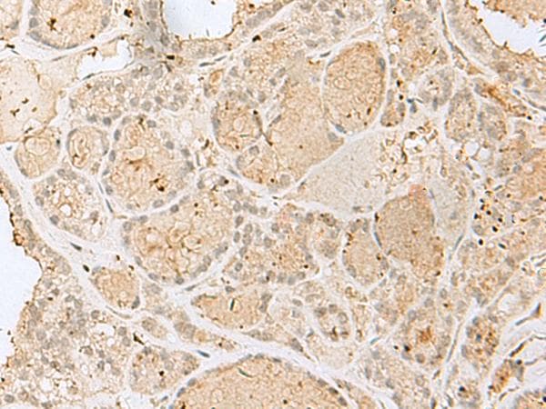 GOLGA7 Antibody