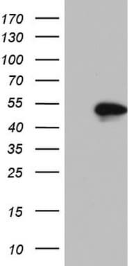 NKX2-1 / Thyroid-Specific TF Antibody (clone OTI2H10)