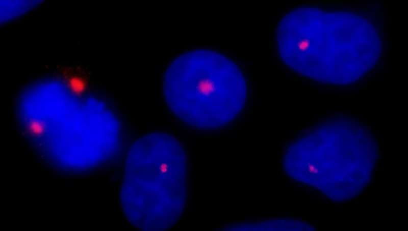 Polyclonal Rabbit anti-Human PCNT / Pericentrin Antibody (aa175-225, IF)