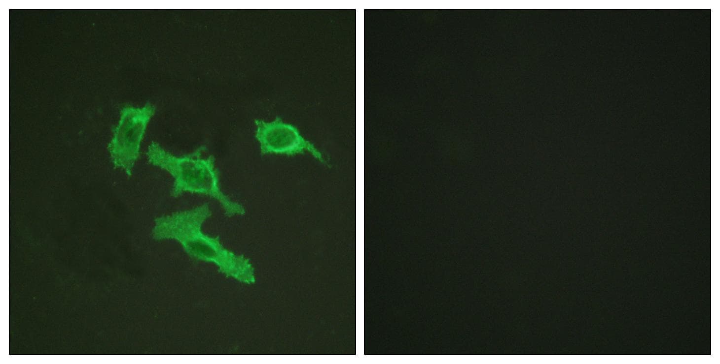 Polyclonal Rabbit anti-Human EGFR Antibody (p1016, IHC, IF, WB)