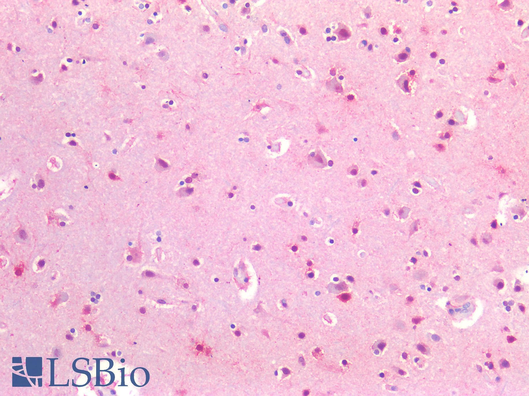 IHC-plus™ SLC17A7 / VGLUT1 Antibody