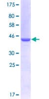 Human UNC5H2 / UNC5B Protein (Recombinant GST, N-terminus)