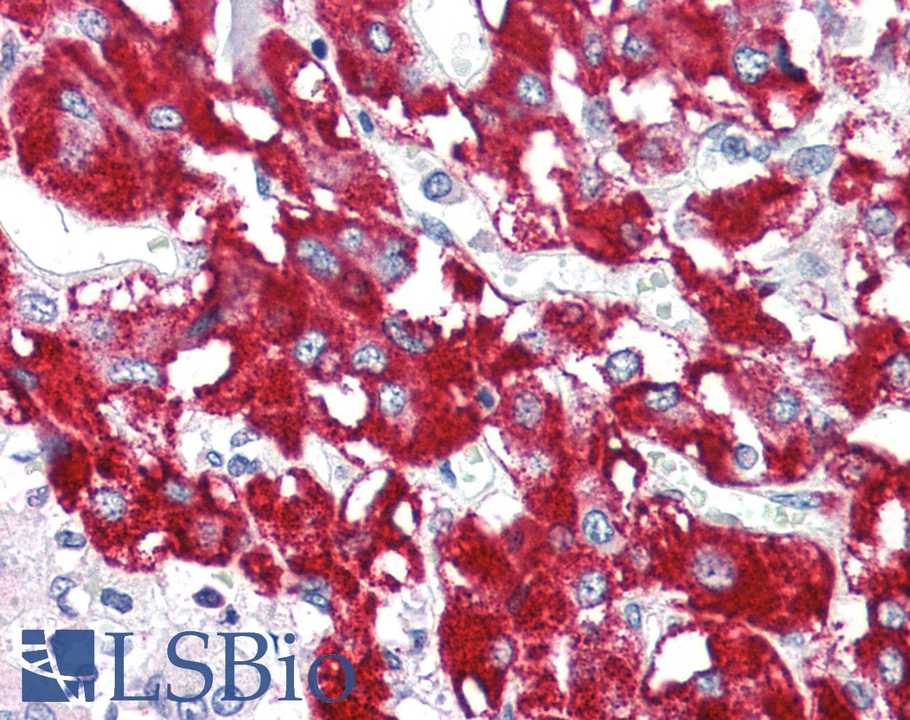 IHC-plus™ Polyclonal Rabbit anti-Human BAG1 / BAG-1 Antibody (IHC, IF, WB)