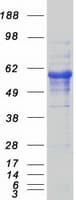Human CD5 Protein (Recombinant Myc-DDK (Flag))