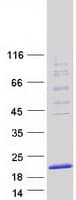 Human TMEM230 Protein (Recombinant Myc-DDK (Flag))