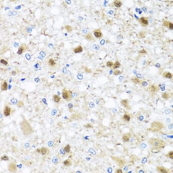 ZBTB17 / MIZ-1 Antibody