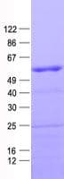 Human HOXD10 Protein (Recombinant His, N-Terminal)