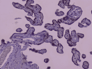 Polyclonal Rabbit anti-Human Capicua / CIC Antibody (IHC)