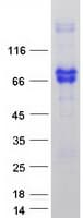 Human NGFR / CD271 / TNR16 Protein (Recombinant Myc-DDK (Flag))