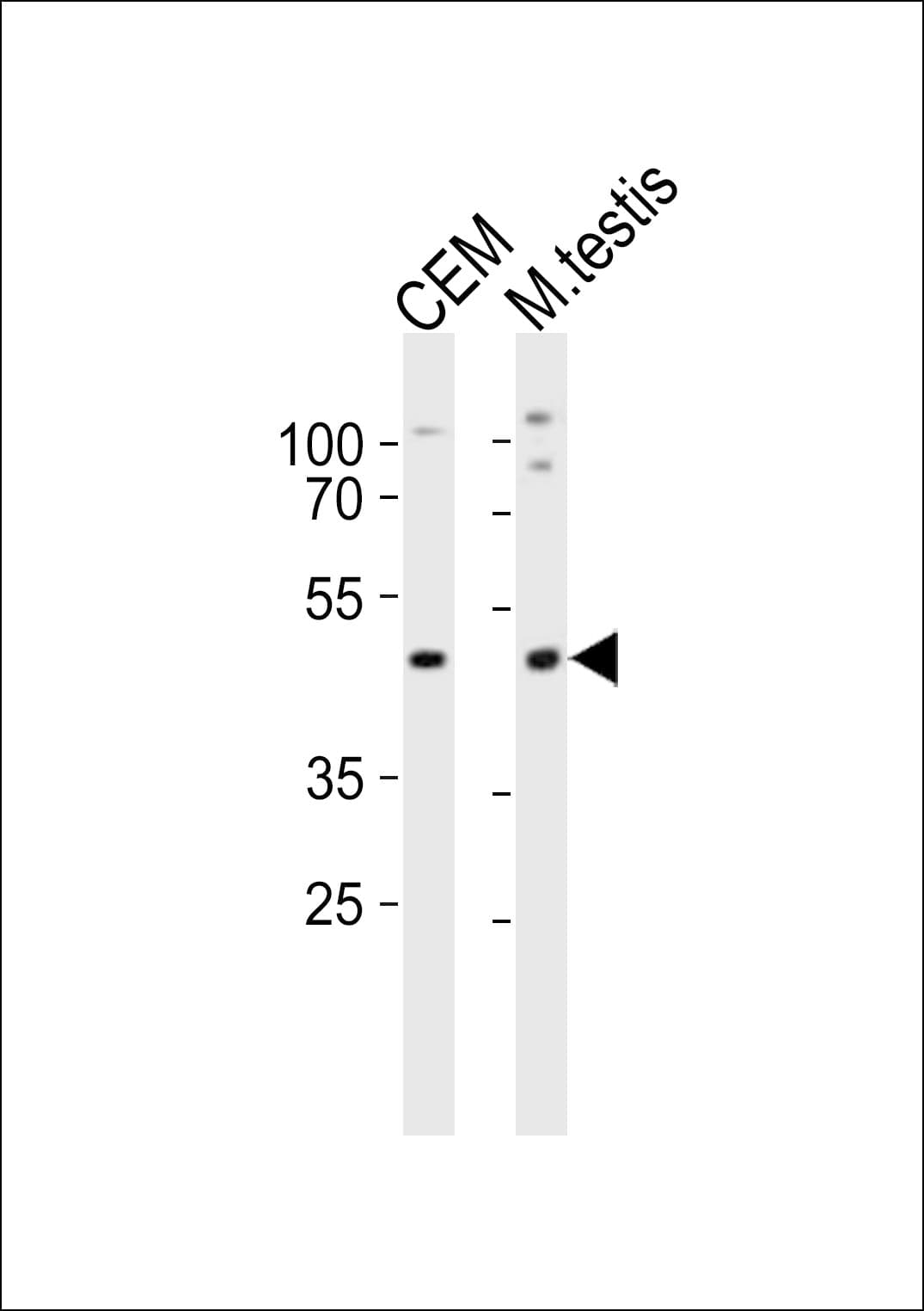 LHX1 Antibody (aa170-204)