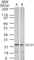 Polyclonal Rabbit anti-Human SOCS1 Antibody (WB)