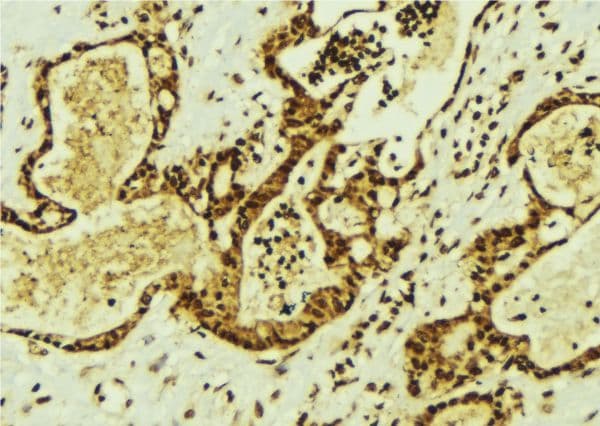 Treacle / TCOF1 Antibody