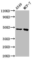 ESRRB / ERR Beta Antibody