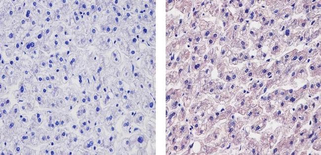APOB / Apolipoprotein B Antibody (clone F2C3)