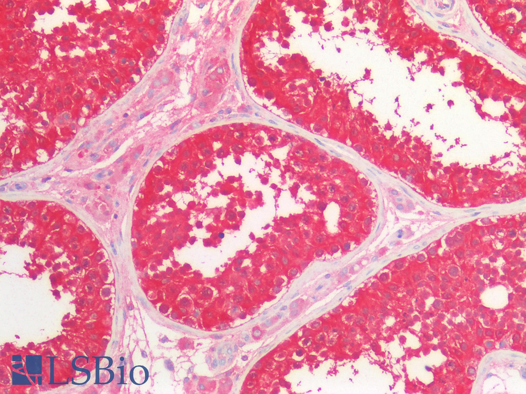IHC-plus™ HPRT1 / HPRT Antibody (aa23-218)