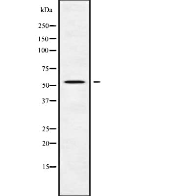 Polyclonal Rabbit anti-Human DFNA5 Antibody (IHC, IF, WB)