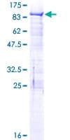Human BRD3 Protein (Recombinant GST)