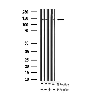 ABL1 / c-ABL Antibody (phospho-Tyr412)