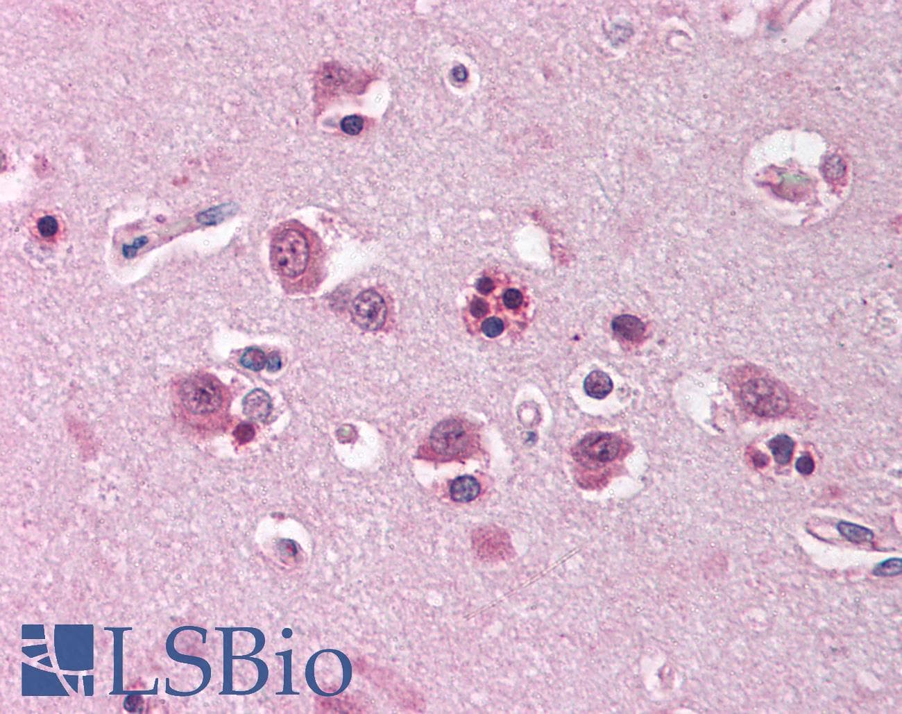 HOMER1 / Homer 1 Antibody (aa101-150)