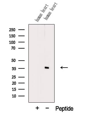 PDLIM3 Antibody