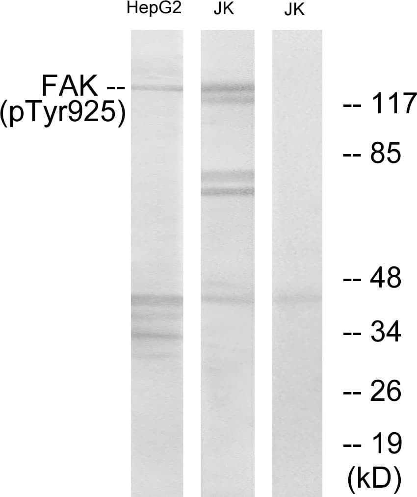 Polyclonal Rabbit anti-Human FAK / Focal Adhesion Kinase Antibody (phospho-Tyr925, WB)